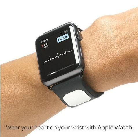 Kardia EKG Apple Watch